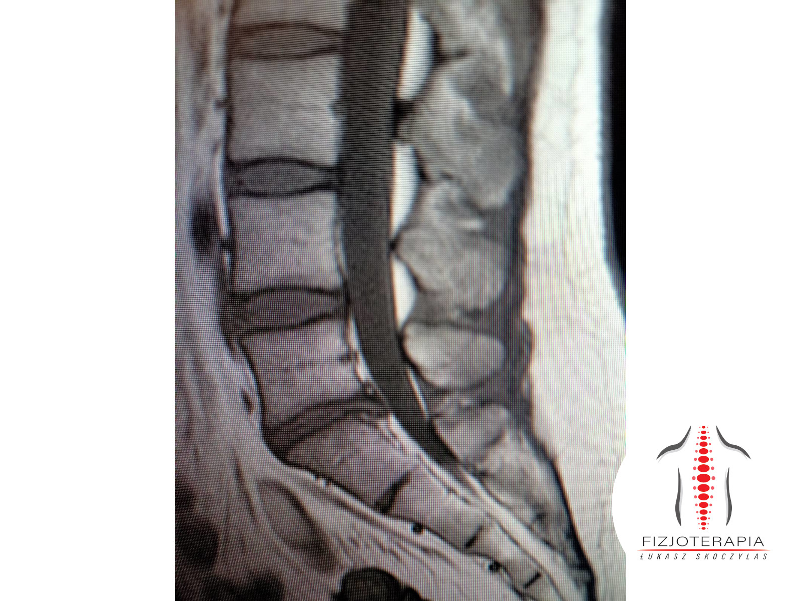 prześwietlenie z logo